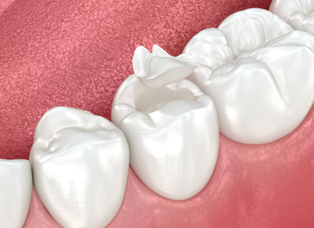 Best Preventive Dentistry  in Burney, CA